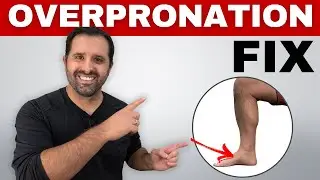 4 Exercises To Correct Overpronation In Runners To Prevent Injury