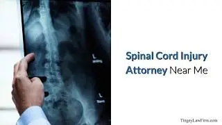 Spinal Cord Injury Lawyer Las Vegas