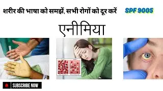 एनीमिया SPF 9005