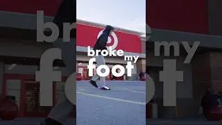 sooo i broke my foot :/ #fyp #shorts