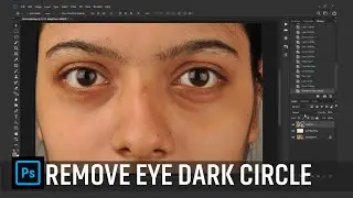 Photoshop Remove Eye Dark Circles