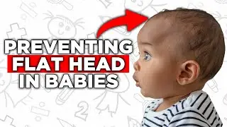 Simple Ways to Prevent Flat Head Syndrome in Babies