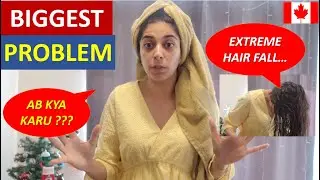 Hair Fall in Canada | Save your Hair from Hard Water | Sangz Stories