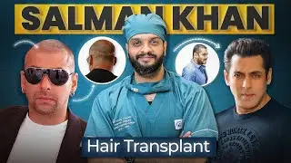 Salman Khan Hair Transplant: Doctor Reacts to Shocking Before & After Journey!