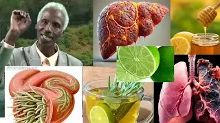 Inzoka, Inkorora n’Izindi Ndwara: Uko Wazirinda mu Buryo bwihuse