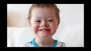 DOWN SYNDROME AWARENESS CSC253