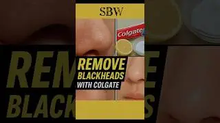 SBW | Viral Colgate Hack | toothpaste hack for skin #shorts #ytshorts #diy#viral#trending#colgate