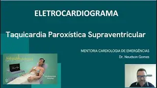 TAQUICARDIA PAROXISTICA SUPRAVENTRICULAR