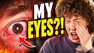 MY EYE IS BURNING
