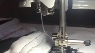 Moving Morgellons fiber going nuts trying to get my finger