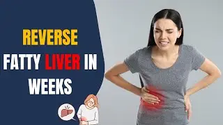 Doctors Reveal: 10 Hidden Causes of Fatty Liver You&rsquo;re Probably Ignoring (Reverse It Naturally!