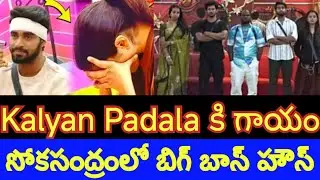 Kalyan padala got head injury in bigg boss season 9