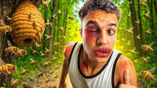 Você Jà Foi Picado Por Abelha?