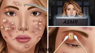 ASMR Acne, Big Blackhead Removal Animation/ASMR CARE ANIMATION COLLECTION/animation,메이크업애니메이션스톱모션