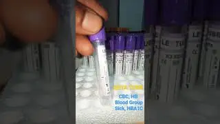EDTA tube and Test name | Dmlt |Bmlt | pathology | tube sample | k shorts