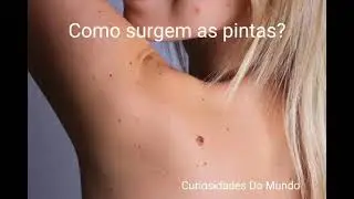 Como surgem as pintas?
