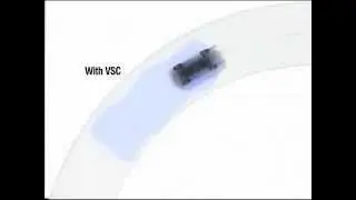 Land Cruiser 200 | Vehicle Stability Control (VSC)