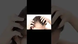 Use that part -2 #skincareproducts #skincarelover #shineeeskin