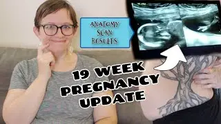 19 Weeks Pregnancy Update ⎮ Anatomy Scan Results!