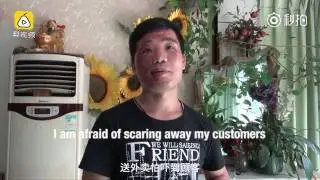 Disfigured food delivery man covers up all the time for fear of frightening customers