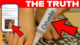 Orivelle Nail Pen Reviews, Scam or Legit, Here&rsquo;s What&rsquo;s Really Going On