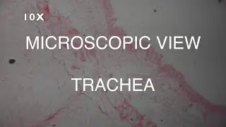 MICROSCOPIC VIEW - TRACHEA