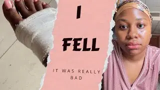 I couldn’t walk for three days!!!😳😭 (domestic accident)