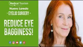 Affordable Eyelid Surgery In Nuevo Laredo | Medical Tourism Mexico