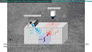 A Reason for Optimism: New Ultrasonic Imaging System Can Detect Deadly Defects in All Type