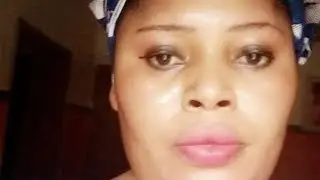 How you can use 20%40%60% monobenzone powder #skincare #affordable