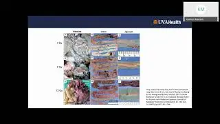 Radiation- Physics, Contamination & Espionage: Part 2