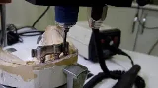 Implant Bar protez (Alanfor)