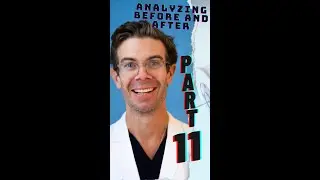 Extended Neck & Jawline Sculpting  | Dr.Caughlin Explainer | #Shorts