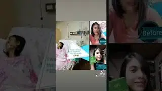 Amazing Barley Testimony .. Super Amazing Result Share to Help more People Contact Me : 09515629969