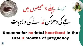 Reasons for no fetal heartbeat in the first 3 months of pregnancy | پہلے 3 مہینے میں بچے کی دھڑکن 
