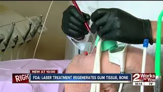 Laser treatment for gum disease has unexpected benefits for diabetics