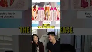 Words That Dentists Avoid Saying (Trying To Answer My Wife's Dental Questions) #dental #dentistry