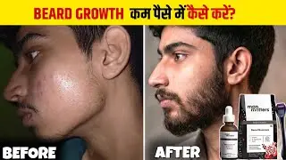 Student  दाढ़ी कैसे उगाए कम पैसे में | Man Matters Beard Growth kit review | minoxidil beard growth