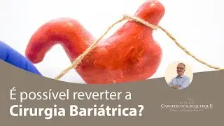 É possível reverter a Cirurgia Bariátrica? | Prof. Dr. Luiz Carneiro CRM 22761