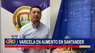 Aumentan los casos de varicela en Santander | Oro Noticias