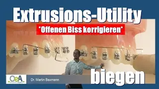 EXTRUSIONS-UTILITY - Offenen Biss korrigieren/anterior open bite correction I OeA