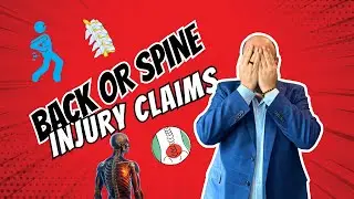 Expert Lawyer for Back or Spine Injury Claims | Las Vegas Injury Attorney (702) 331-5722