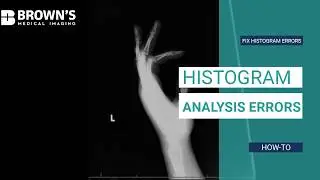 Understanding and Correcting Histogram Analysis Errors in Radiology