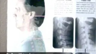 Fort Collins Chiropractor, Dr. Ryan Weisgerber 