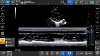 Venue&trade; Family R3 Tutorial - M-Mode