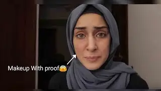 Froggy Didn't Got Punched With Proof|End Of Sham And Froggy Drama|Proof When Froggy Got Punched!!!