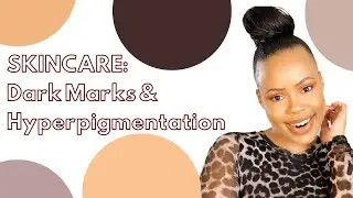 How to get rid of DARK MARKS & HYPERPIGMENTATION #SKINCARE