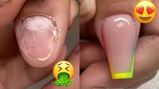 #123✨Incredible Nail Transformation Acrylic Nail Art Designs Compilation 💅