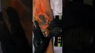 Unbelievable Tattoo Timelapse!: Scar Cover-Up Ideas | Art Of Scars | #Shorts
