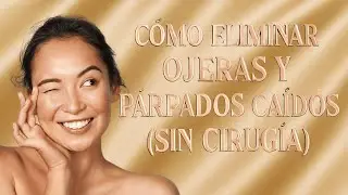 ✅ Adi&oacute;s a las ojeras y p&aacute;rpados ca&iacute;dos: lo que S&Iacute; funciona (sin bistur&iacute;)